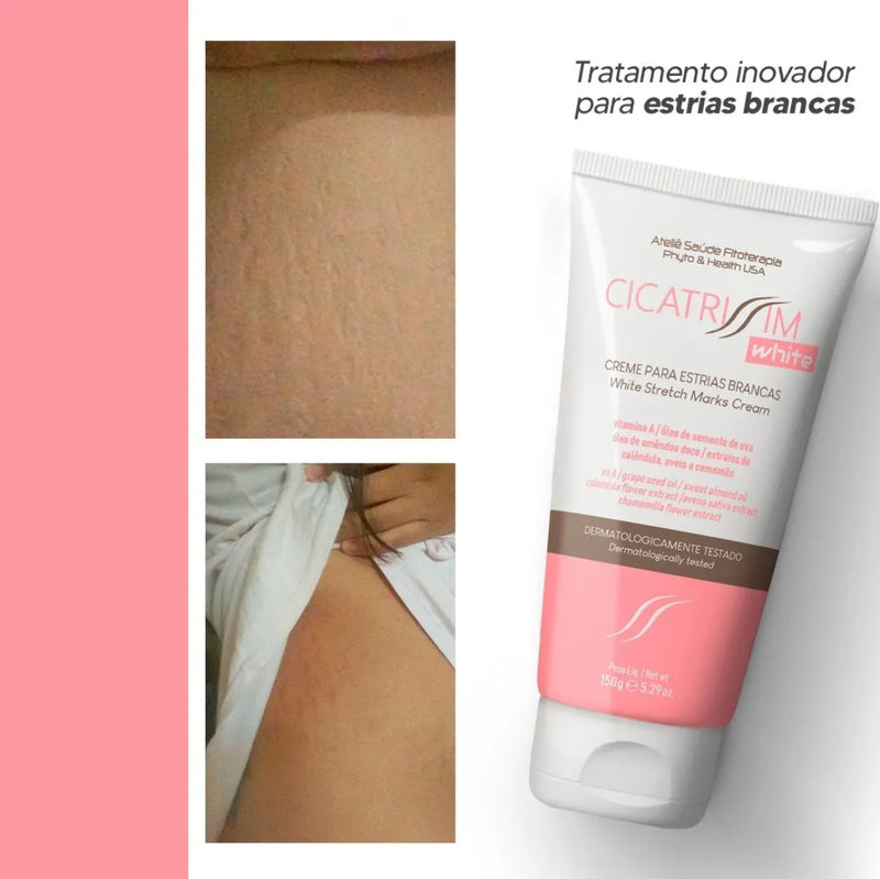 Cicatrissim White - Specific cream for white stretch marks
