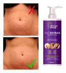 Anti-Stretch Mark Cream 200g Morena Brasil Fragrance Free