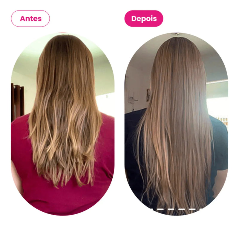 Gummy Hair Vitamin Watermelon Supplement 180g for Hair and Nails