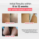 Cicatrissim White - Specific cream for white stretch marks